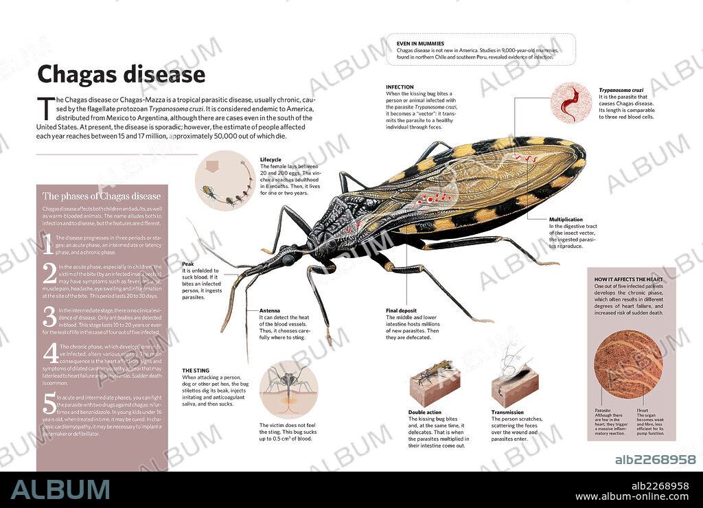 Mal de Chagas. Infografía sobre el Mal de Chagas o de Chagas-Mazza, una enfermedad parasitaria tropical causada por el protozoo Trypanosoma cruzi.