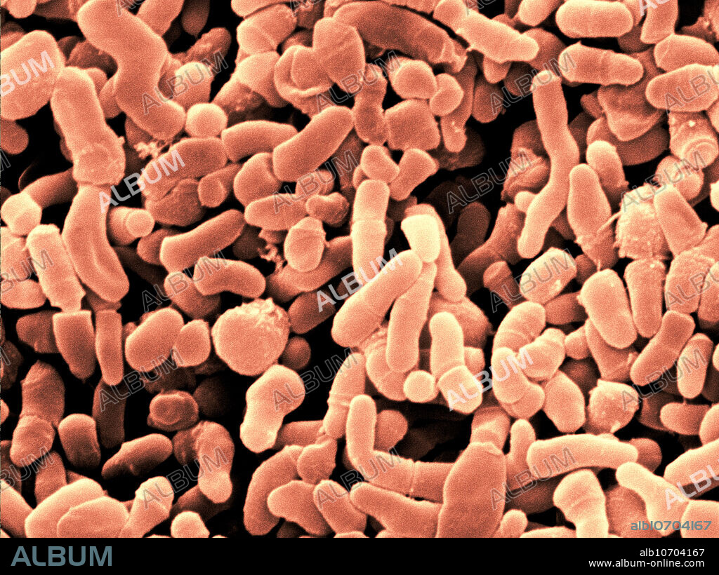 Colour enhanced scanning electron micrograph (SEM) of propionibacterium acnes. This bacteria inhabits sebaceous follicles and is usually a harmless commensal bacterium inhabiting human skin but is known to cause the formation of acne vulgaris (pimples). The bacterium is anaerobic, gram-positive and does not form spores. It produces propionic acid, indole, nitrate, and catalase but it is not toxigenic. Morphologically, it resembles corynebacteria. Image width: 9.85 micrometers. Magnification: 10,150x if printed 10 cm wide.
