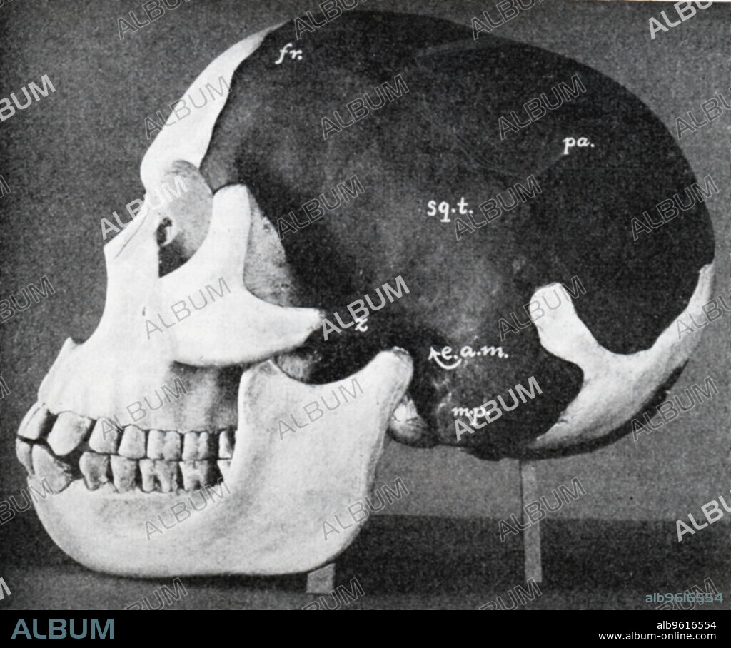 Model of the skull of Piltdown Man (Eanothropus dawsoni), 1914. Model as reconstructed by Dr Smith Woodward. Dark areas are from the original fossil, the light are the restored areas. Most of the lower jaw is restored on the far side. This supposed fossil was 'discovered' near Lewes, Sussex, in 1912 by Charles Dawson, a local solicitor and amateur archaeologist. Postulated to be a 'missing link' in human evolution, in 1954 it was proved to be a hoax, a human cranium skilfully connected to the jaw of an orang-utan. From Scientific American, 7 November 1914.