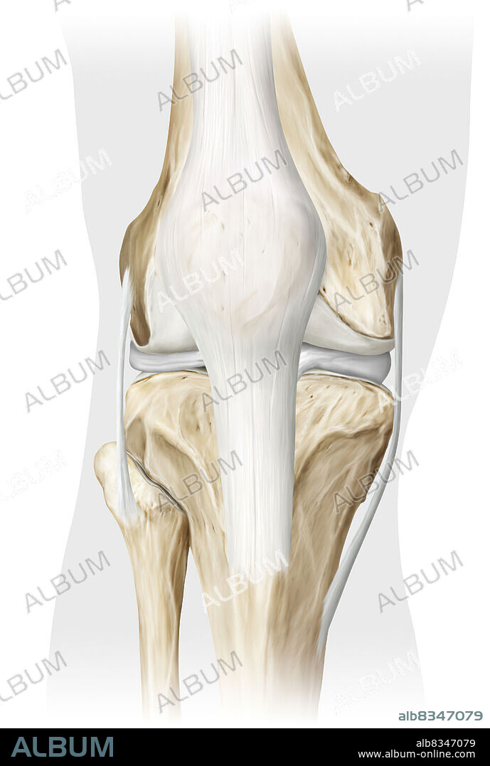 The synovial joint of the knee links the femur to the tibia, the fibula, and the patella. As a result, the knee refers to the area of the body where the thigh meets the calf. Used often, it is reinforced and stabilized by multiple ligaments and the menisci.