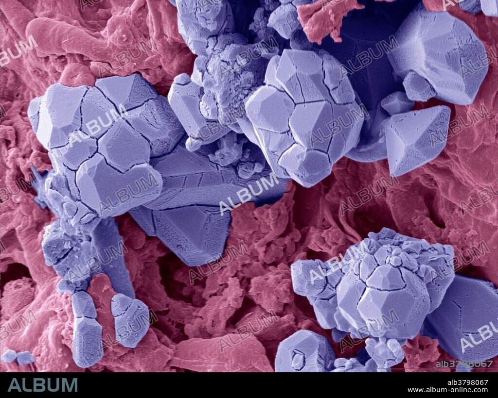Red yeast rice results from fermenting regular rice with a fungus Monascus purpureus. The fungus partially digests the rice starch granules and produces naturally occurring statins, i.e., substances known to inhibit the production of cholesterol in humans.The statins crystallize on the rice grain surface. Thus, with red yeast rice, the Chinese have been ingesting statins for over a thousand years. The fungus produces Monacolin K, also known as mevinolin, which is the same active statin as the drug Lovostatin. Enhanced SEM. Image width: 42.5 micrometers, magnification: 2353x if the image is printed 10 cm wide. Bar: 10 micrometers.