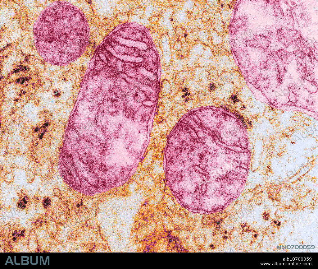 Mitochondria and Endoplasmic Reticulum, TEM