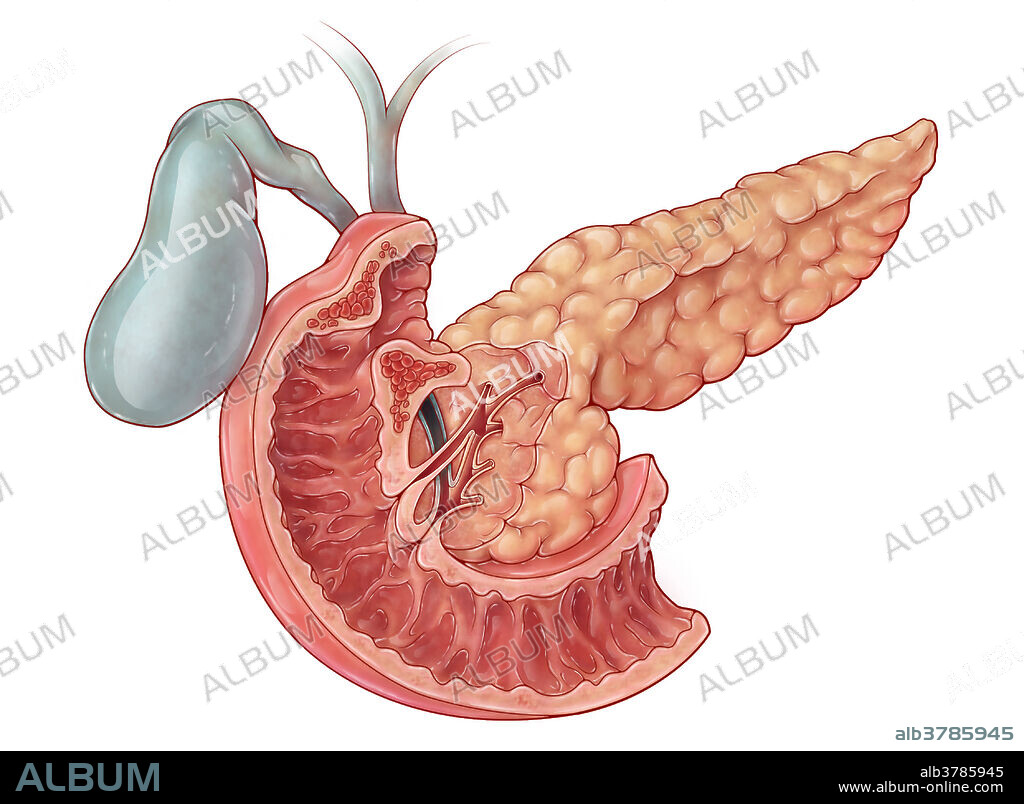 An illustration of the pancreas, an organ which acts as both an endocrine gland and digestive organ. The pancreas produces a variety of endocrine hormones such as insulin, glucagon, somatostatin and pancreatic polypeptide. During digestion, the exocrine pancreas produces bicarbonate ions to neutralize acidic chyme from the stomach, as well as secrete pancreatic juice containing digestive enzymes to break down carbohydrates, lipids and proteins. The gallbladder (green) and a section of the duodenum are also included in the illustration.
