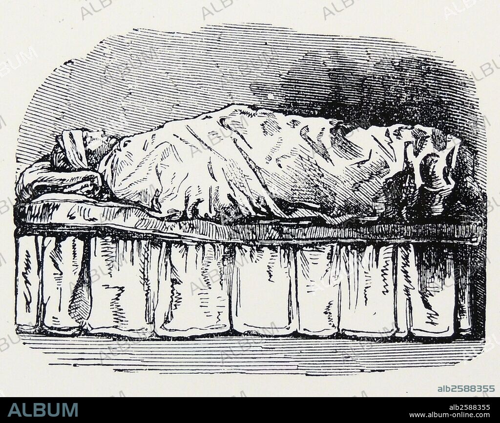 Wet Pack,  Patient wrapped in cold, wet sheet for up to 60 minutes, patient then took a cold plunge. Used for many conditions from constipation to rheumatism. From ''Practical Hydropathy'', London, 1863.