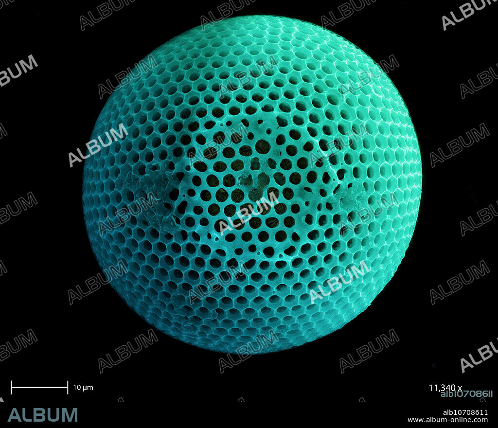 SEM of a fossil freshwater diatom. Diatoms are single-celled photosynthetic algae. They have mineralized cell walls that contain silica and provide protection and support. The diatoms form an important part of the plankton at the base of the marine and freshwater food chains. Magnification: 11,340x and the calibration bar is 10 um.