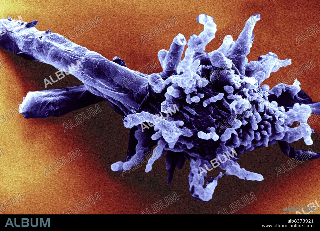 Amoeba proteus, viewed under SEM.