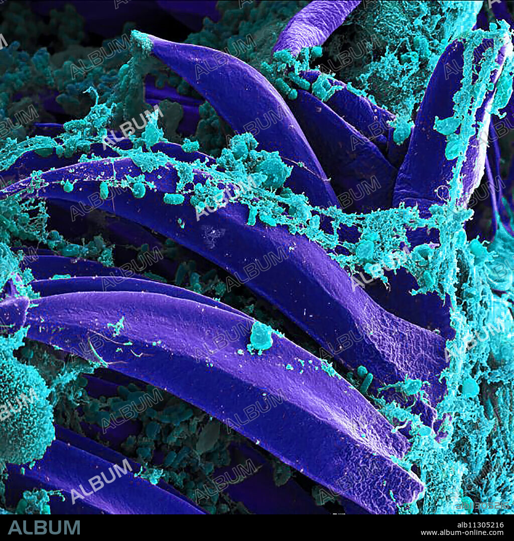Scanning electron micrograph of Yersinia pestis, which causes bubonic plague, on proventricular spines of a Xenopsylla cheopis flea.