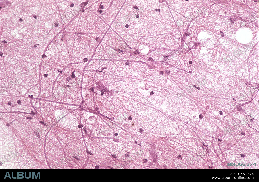 Neuron smear of the spinal cord of a cow. Magnification: 100x.
