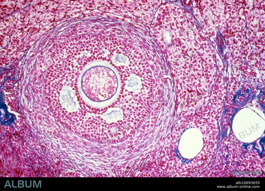 Light micrograph showing human female graafian follicle, also called a secondary follicle or vesicular ovarian follicle.