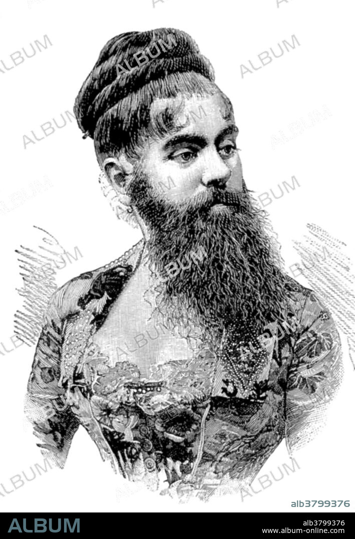 Annie Jones Elliot (July 14, 1865 - October 22, 1902) was an American bearded woman. She toured with showman P. T. Barnum as a circus attraction. Whether the cause of her condition was hirsutism or an unrelated genetic condition that affects children of both sexes and continues into adult years is unknown. Many photographers, including Mathew Brady, took her portraits during her lifetime, which were widely distributed. When Jones joined Barnum's exhibition as a child of only nine months, her parents received a $150/week salary. She was billed as a new "infant Esau." By the age of five, she had a mustache and sideburns and became well known as the "Bearded Girl." Photographer Mathew Brady took Jones' portrait as a child in 1865. As an adult, she became the country's top "bearded lady" and acted as a spokesperson for Barnum's "Freaks", a word she tried to abolish from the business. Jones married Richard Elliot in 1881, but divorced him in 1895 for her childhood sweetheart William Donovan, who died, leaving Jones a widow. She died In 1902, at the age of 37, of tuberculosis.