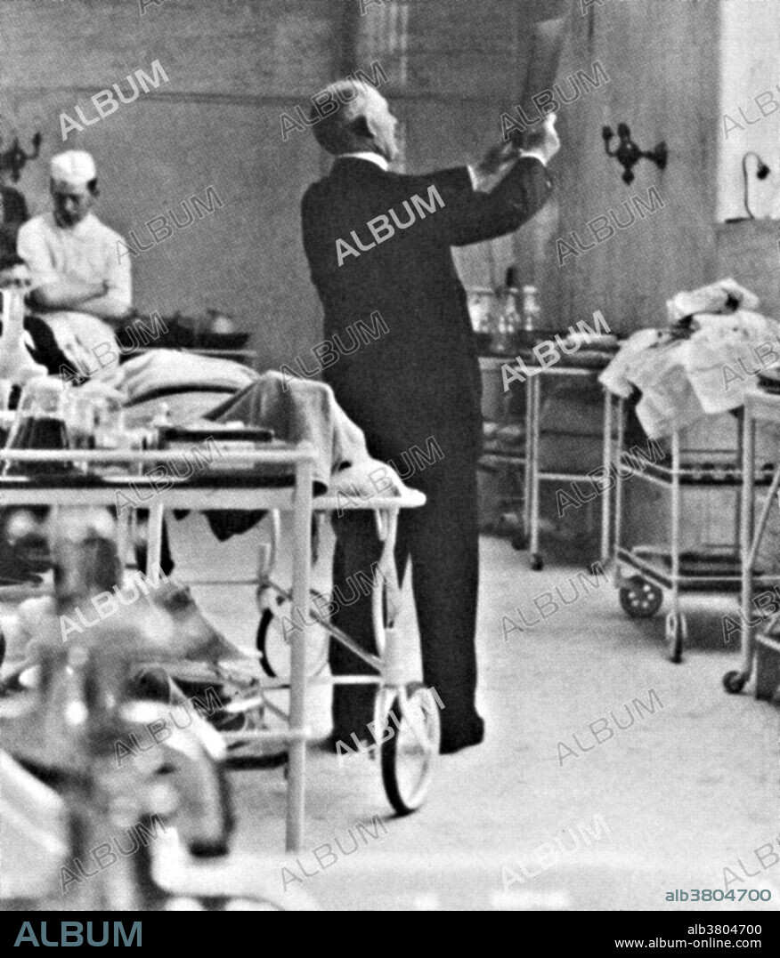 William Stewart Halsted, Professor of Surgery at Johns Hopkins, examines an x-ray plate. Halsted (1852-1922) was an American surgeon who emphasized strict aseptic technique during surgical procedures, was an early champion of newly discovered anesthetics, introduced the use of rubber gloves in surgery and several new operations, including the radical mastectomy for breast cancer. Halsted was one of the "Big Four" founding professors at Johns Hopkins Hospital.