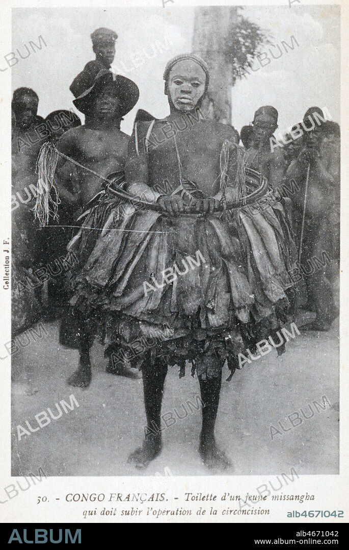 'Congo francais : toilette d'un jeune missanga qui doit subir l'operation de circoncision'. Carte postale vers 1910. Credit : Collection IM/KHARBINE-TAPABOR.