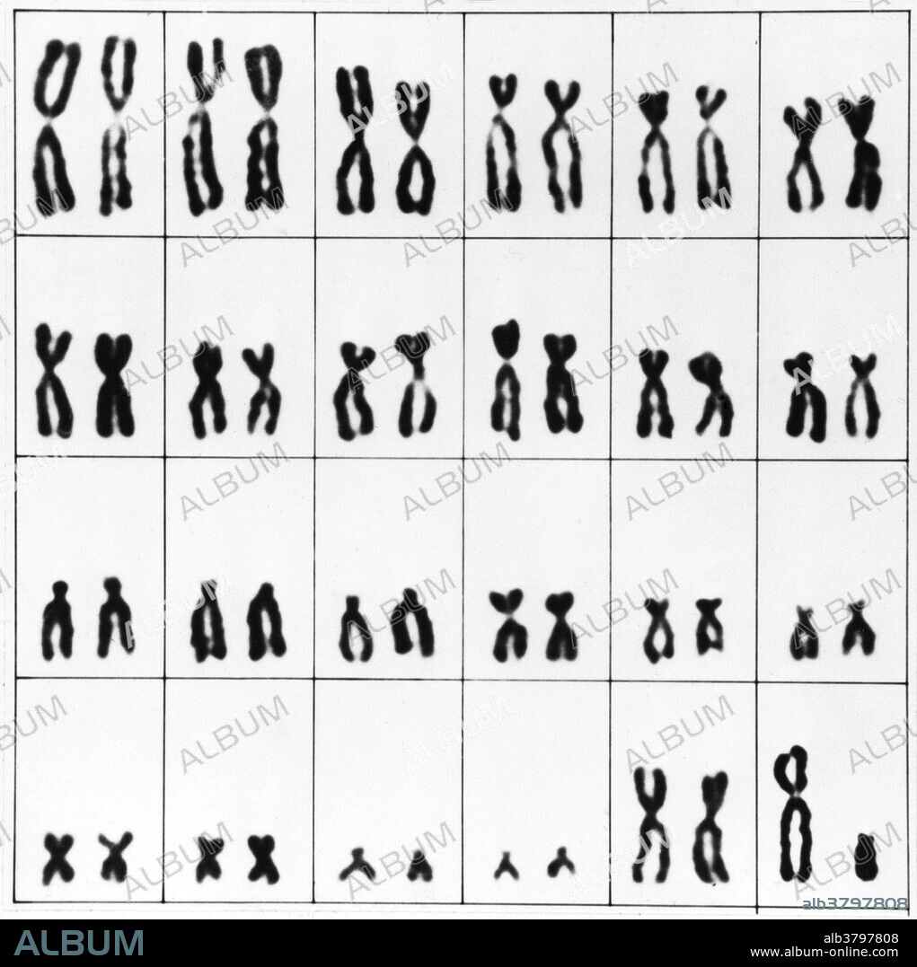 Normal male chromosomes. This karyotype shows the 46 chromosomes found in most cell nuclei in a man's body. There are 22 pairs of chromosomes and also the gender determining pair (lower right corner). In men, this comprises one X and one Y chromosome. In women, it is made up of two X chromosomes. The Y chromosome carries genetic information responsible for the development of male characteristics. Chromosomes carry genetic information in the form of genes, lengths of DNA that act as recipes for proteins. Karyotypes are an arrangement of chromosomes based on their appearance under a light microscope.