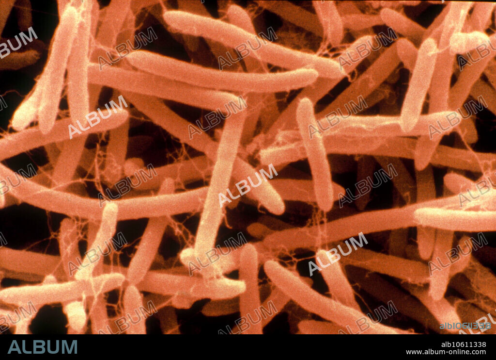 Color-enhanced Scanning Electron Micrograph (SEM) showing Aneurinibacillus migulanus (formerly Bacillus brevis). This species of gram-positive, rod-shaped, motile, spore-forming bacteria is found in soil and foods. It is rarely associated with infectious diseases. W = 19.0 m at 35mm.