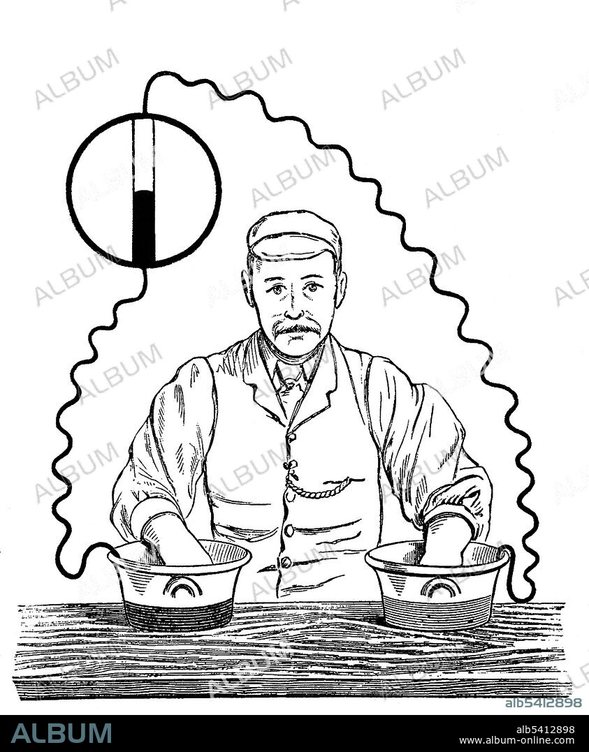 Augustus Waller, ECG Demonstration, 1888