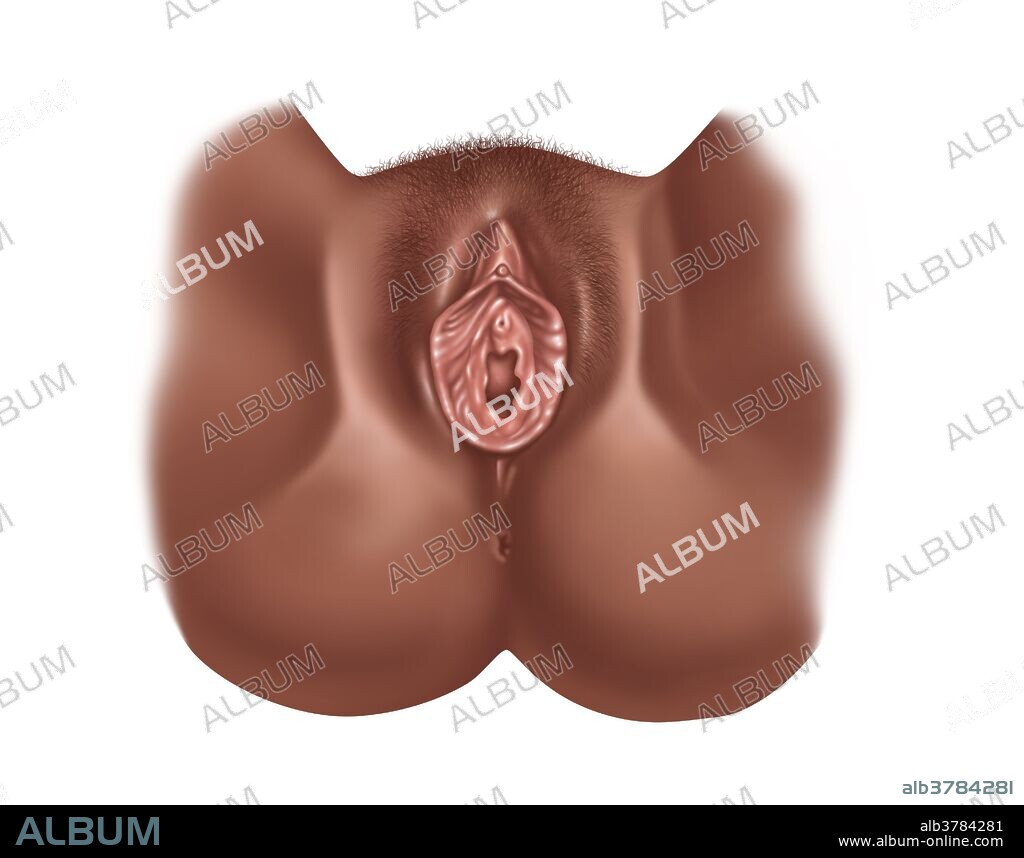 Illustration showing the anatomy of a normal vagina with pubic hair. Depicted are: clitoris, urethra, labia majora, vaginal opening, and the labia minora.