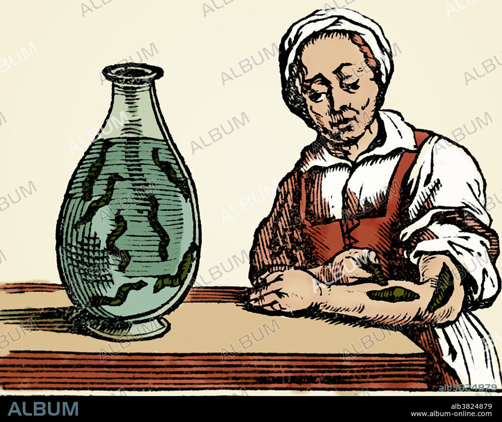 Bloodletting, Leech Method