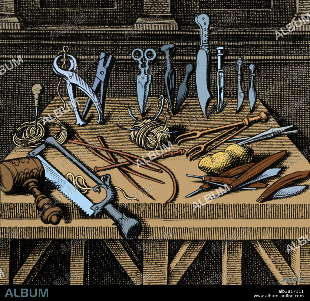 Vignette from the title page of Workes of that famous French surgeon Ambroise Pare, 1634. Surgical equipment and instruments arranged on a table. Ambroise Pare (1510 - December 20, 1590) was a French surgeon, anatomist and inventor. He was royal surgeon for kings Henry II, Francis II, Charles IX and Henry III and is considered one of the fathers of surgery and modern forensic pathology. He was a leader in surgical techniques and pioneered modern battlefield wound treatment. Battlefield medicine is the treatment of wounded soldiers in or near an area of combat. Civilian medicine has been greatly advanced by procedures that were first developed to treat the wounds inflicted during combat. Pare introduced the ligature of arteries instead of cauterization during amputation. He believed that phantom pains occurred in the brain. He contributed to the practice of surgical amputation and the design of limb prostheses. He died in 1590 from natural.