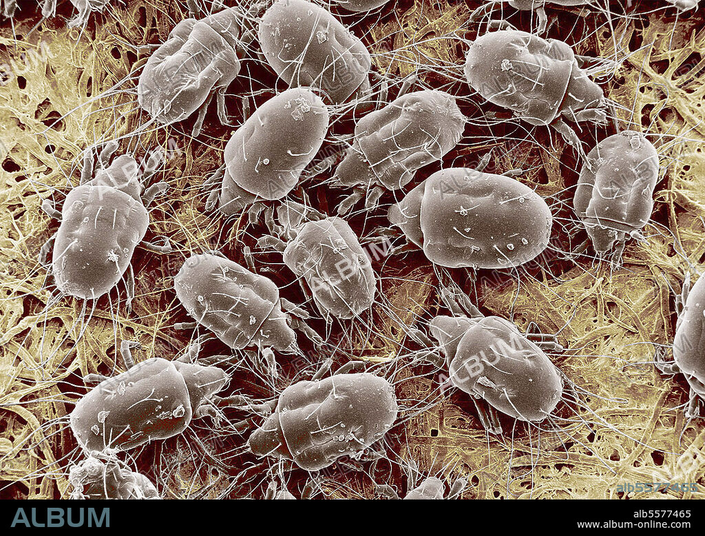 Under a magnification of 100X, this scanning electron microscopic (SEM) image, reveals some of the ultrastructural morphology exhibited by a grouping of ham mites, Tyrophagus putrescentiae. The ham mite is an agricultural pest, at times, infesting high moisture grain, semi-moist pet foods, cheeses, and dried meats. It is also referred to as the cheese mite, mold mite or copra mite.