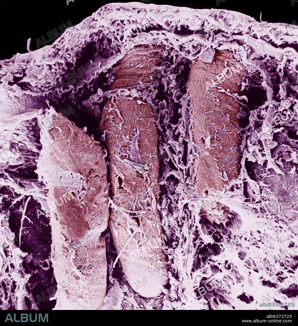 Transversal section of the colon.. SEM x 150.