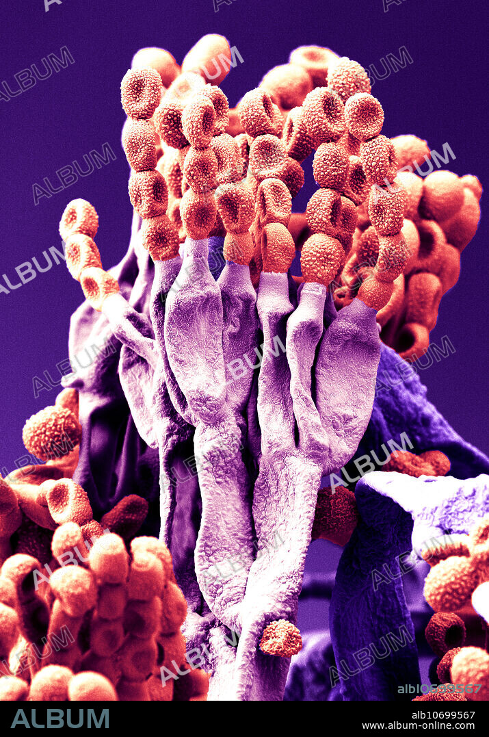 Penicillium chrysogenum, under a microscope (SEM)