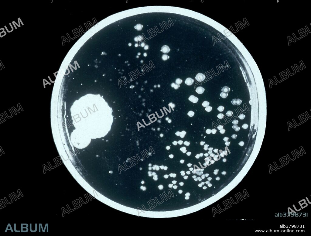 Fleming's original culture plate of the fungus Penicillium notatum, which led to the discovery of the antibiotic penicillin. Alexander Fleming (August 6, 1881 - March 11, 1955) was a Scottish biologist and pharmacologist. He wrote many articles on bacteriology, immunology, and chemotherapy. His best-known discoveries are the discovery of the enzyme lysozyme in 1923 and the antibiotic substance penicillin from the mold Penicillium notatum in 1928, for which he shared the Nobel Prize in Physiology or Medicine in 1945 with Howard Florey and Ernst Boris Chain. Fleming's accidental discovery and isolation of penicillin marked the start of modern antibiotics. He also discovered that bacteria developed antibiotic resistance whenever too little penicillin was used or when it was used for too short a period. Almroth Wright had predicted antibiotic resistance even before it was noticed during experiments. Fleming cautioned about the use of penicillin in his many speeches around the world. In 1999, Time magazine named Fleming one of the 100 Most Important People of the 20th Century. He died in 1955 from a heart attack at the age of 73.