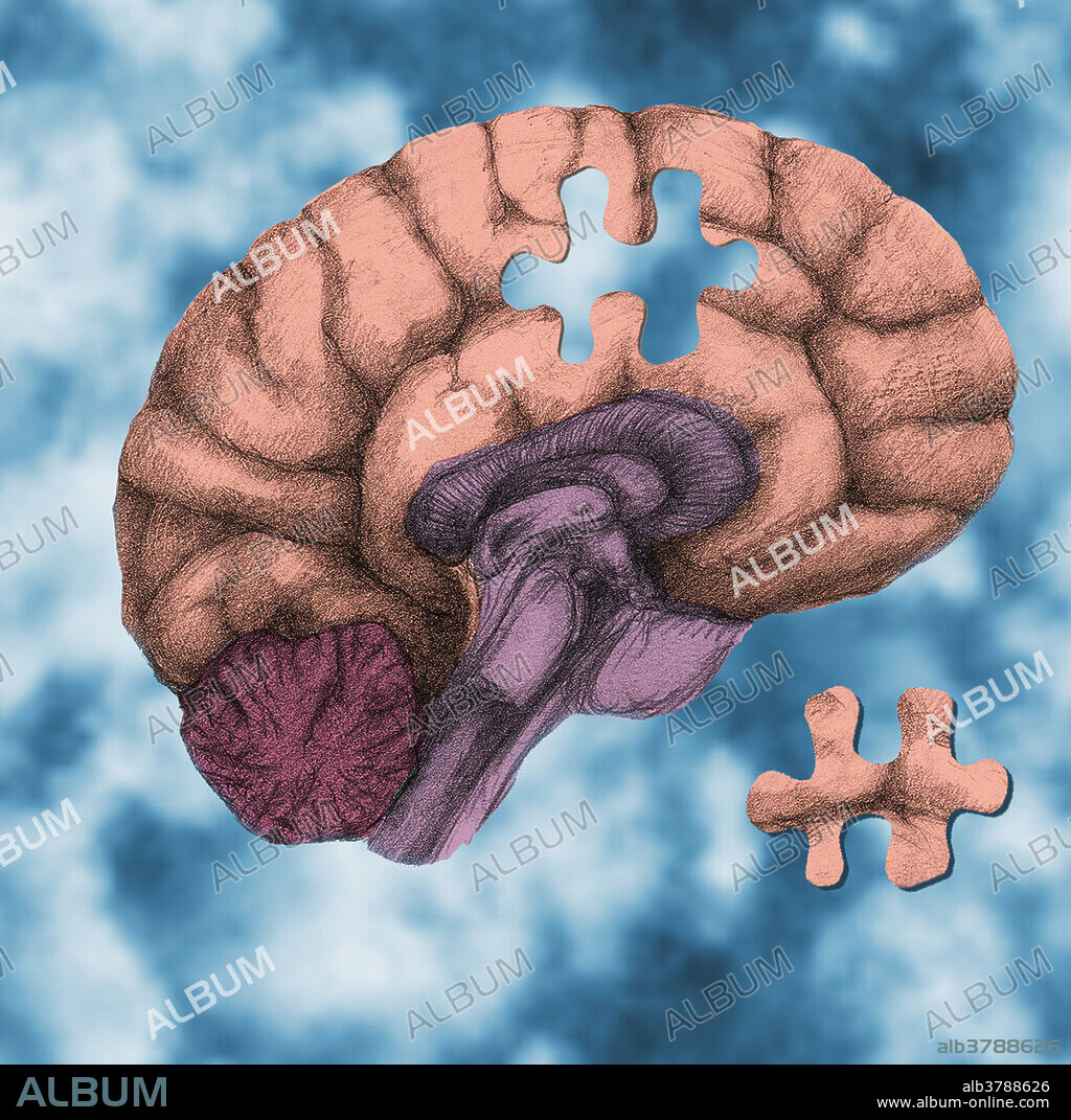 A conceptual image showing a brain floating in clouds with a puzzle piece missing, which could be used to illustrate brain function, brain damage, Alzheimer's disease, brain complexity, memory loss, mental health, forgetfulness, dementia, or the puzzles of neuroscience.