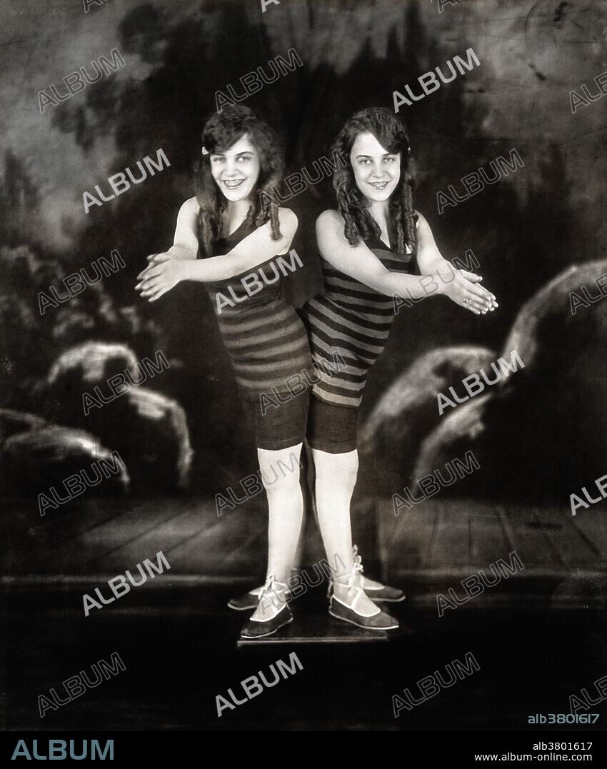 Daisy and Violet Hilton, conjoined twins, wearing swimsuits and posing as though about to dive. Photograph, c. 1927. Daisy Hilton and Violet Hilton (1908 - 1969) were a pair of British conjoined twins or Siamese Twins who toured in the U.S. sideshow and vaudeville circuit in the 1930s.The sisters were born joined by their hips and buttocks; they shared blood circulation and were fused at the pelvis but shared no major organs. These conjoined twins were the first born in the United Kingdom that survived for more than a few weeks. In 1926 Bob Hope formed an act called the Dancemedians with the Hilton Sisters, who had a tap-dancing routine. In 1932, the twins appeared in the film Freaks. They died at age 60 of the Hong Kong Flu.
