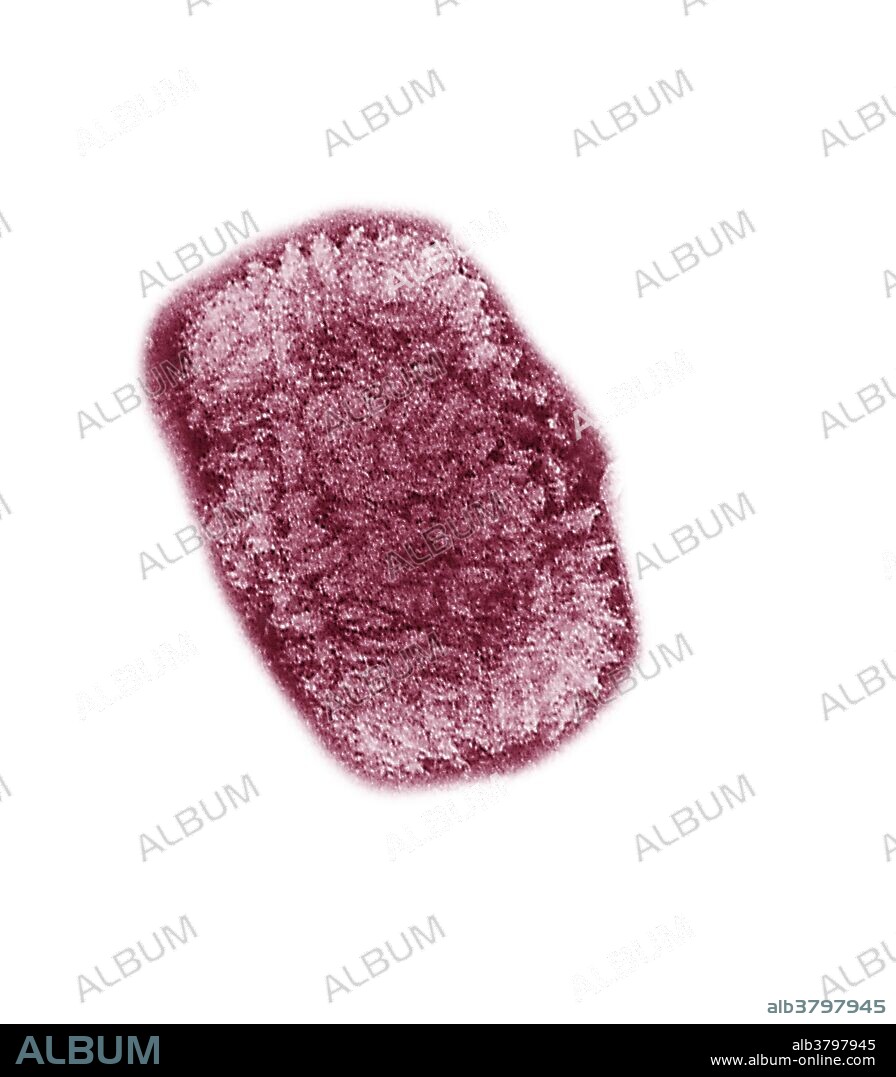 Color enhanced Transmission Electron Microscope (TEM) of the Vaccinia virus. A member of the poxvirus family, it is very close to the smallpox virus. As a result, it is commonly used to make the vaccine against the smallpox. Vaccinia virus (VACV or VV) is a large, complex, enveloped virus with a linear, double-stranded DNA genome. Smallpox was the first disease to be widely prevented by vaccination due to pioneering work by Edward Jenner in the 18th century. Vaccinia virus is the active constituent of the vaccine that eradicated smallpox, making it the first human disease to be eradicated. Vaccinia virus is closely related to the virus that causes cowpox; historically the two were often considered to be one and the same. The precise origin of vaccinia virus is unknown due to the lack of record-keeping as the virus was repeatedly cultivated and passaged in research laboratories for many decades. The most common notion is that vaccinia virus, cowpox virus, and variola virus were all derived from a common ancestral virus. There is also speculation that vaccinia virus was originally isolated from horses. Poxviruses are unique among DNA viruses because they replicate only in the cytoplasm of the host cell, outside of the nucleus. Magnification: unknown.