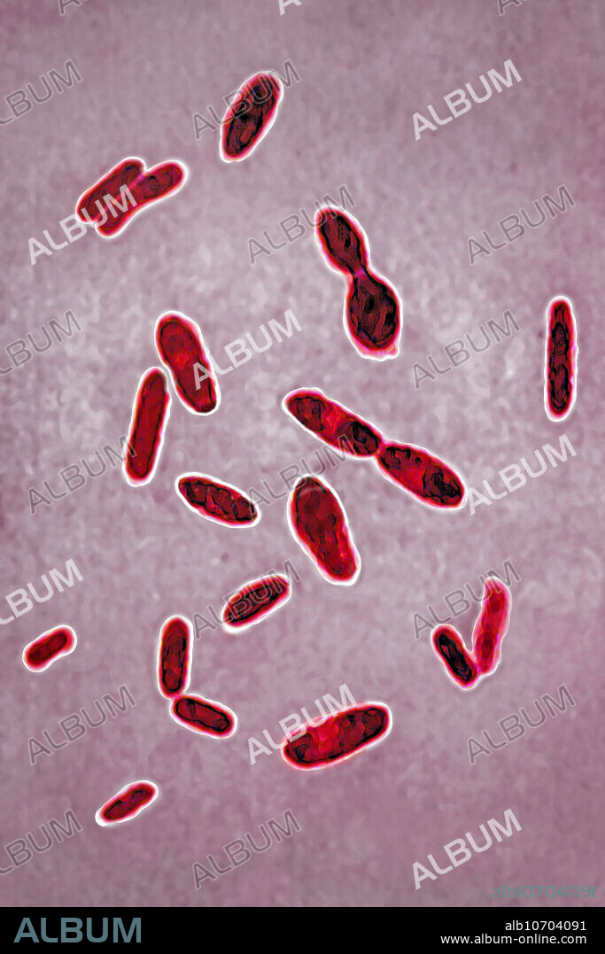 Clostridium tetani, light micrograph