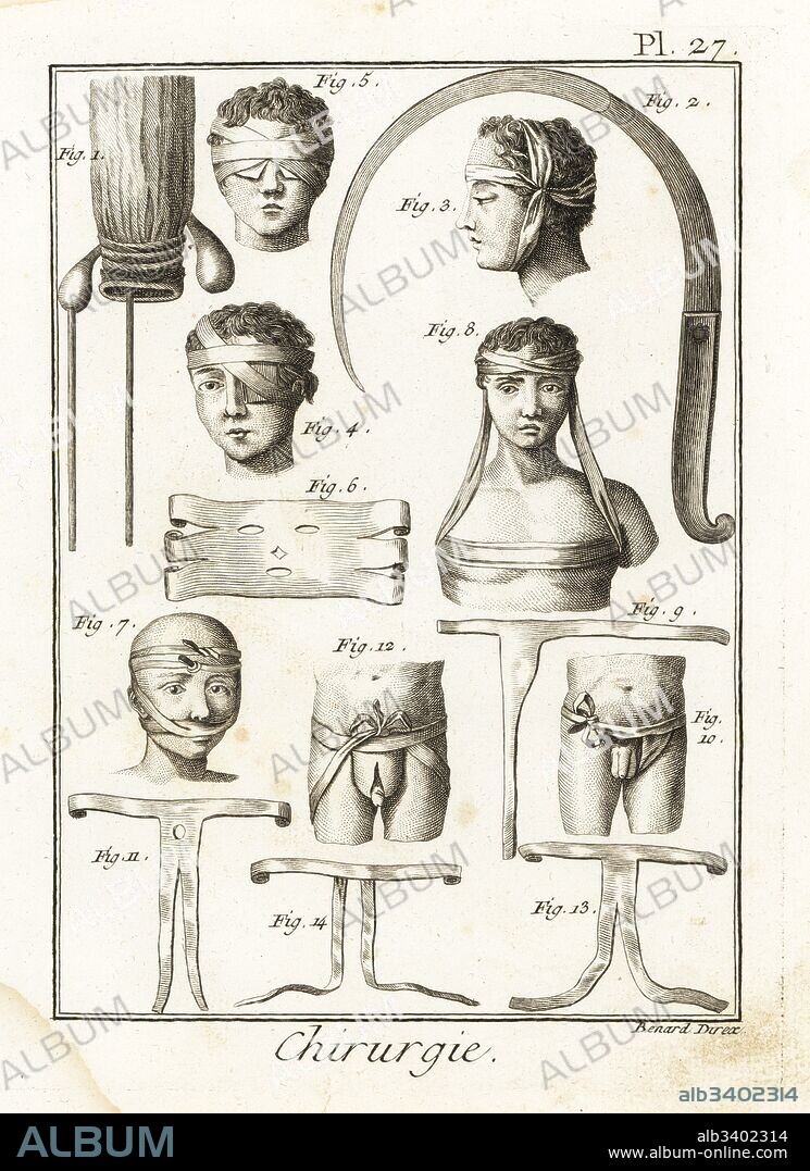 Rectum with sistule 1, syringotome scalpel 2, solar bandage 3, eye bandages 4,5, face mask 6, upperlip bandage 7, head divider 8, hernia bandages 9,10 and T bandages 11-14. Copperplate engraving by Robert Benard from Denis Diderot's Encyclopedia, Pellet, Geneva, 1779.