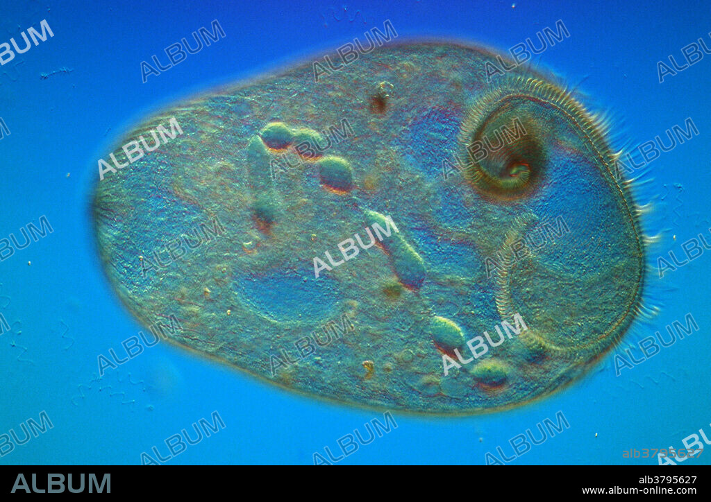 Stentor coeruleus, a protozoan that lives in freshwater and feeds on smaller microorganisms.