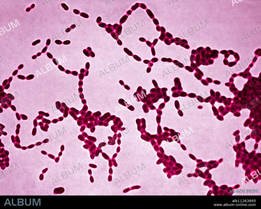 Haemophilus ducreyi, or Ducrey's bacillus, is transmitted by sexual contact (STD), it is an extremely contagious bacterium that does not provide immunity. It causes chancroid (or chancre or Ducrey's chancre), characterized by an ulcerated chancre associated with lymphadenopathy. Visualization by Optical Microscopy.