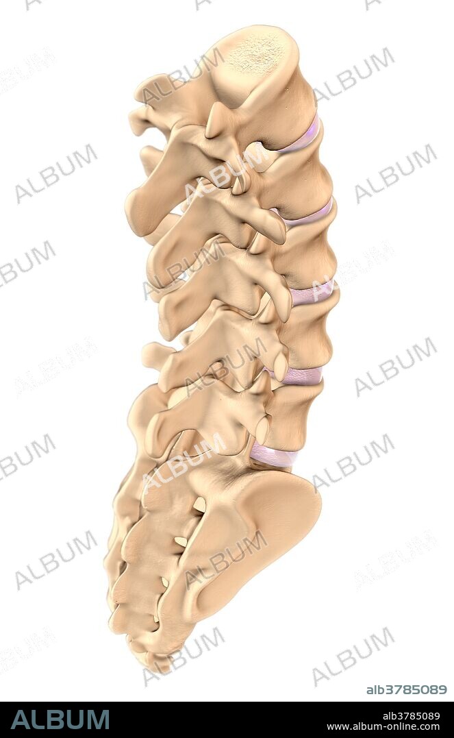An illustration of the lower spine from a posterolateral view, showing the five lumbar vertebrae, the intervertebral discs (pink), and sacrum.