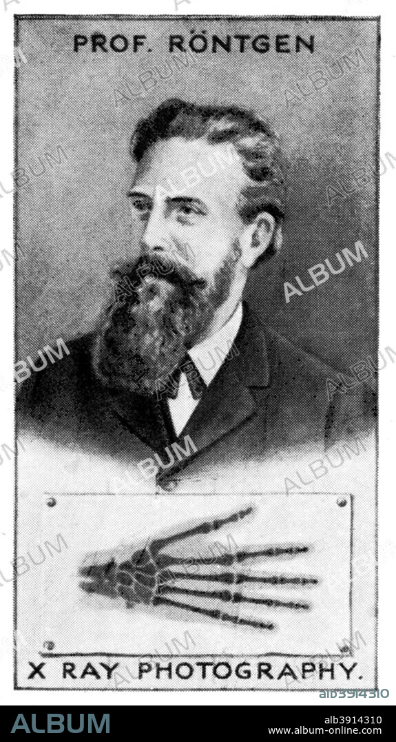Wilhelm Conrad Roentgen, German physicist, (c1924). On 8 November 1895, Roentgen (or Röntgen, 1845-1923) discovered what came to be known as 'X-rays'. He noticed that when a current was passed though a Crookes tube covered with a piece of black card, a nearby piece of paper painted with barium cyanide fluoresced. Later, he found that these X-rays passed through flesh, enabling the bones to be clearly seen. In 1901, he was the first recipient of the Nobel Prize for Physics.