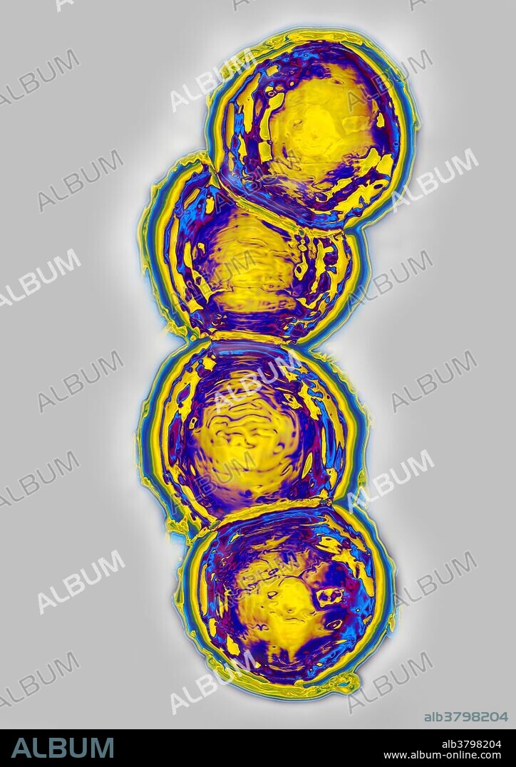Streptococcus pneumoniae