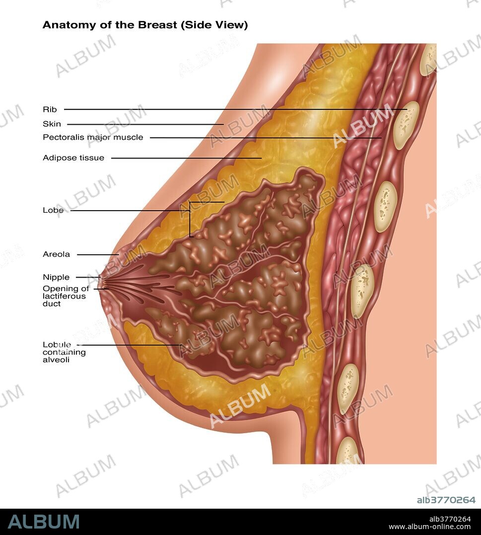 Illustration detailing the anatomy of a female breast. Depicted are the ribs (tan spots), skin (outer most layer), pectoris major muscle (red muscle tissue), adipose tissue (orange), lobe (light pink surrounding the brown area), nipple (light pink center point), opening of lactiferous duct, suspensory ligaments (light pink strands), and lobules (brown) containing alveoli (light pink clusters).