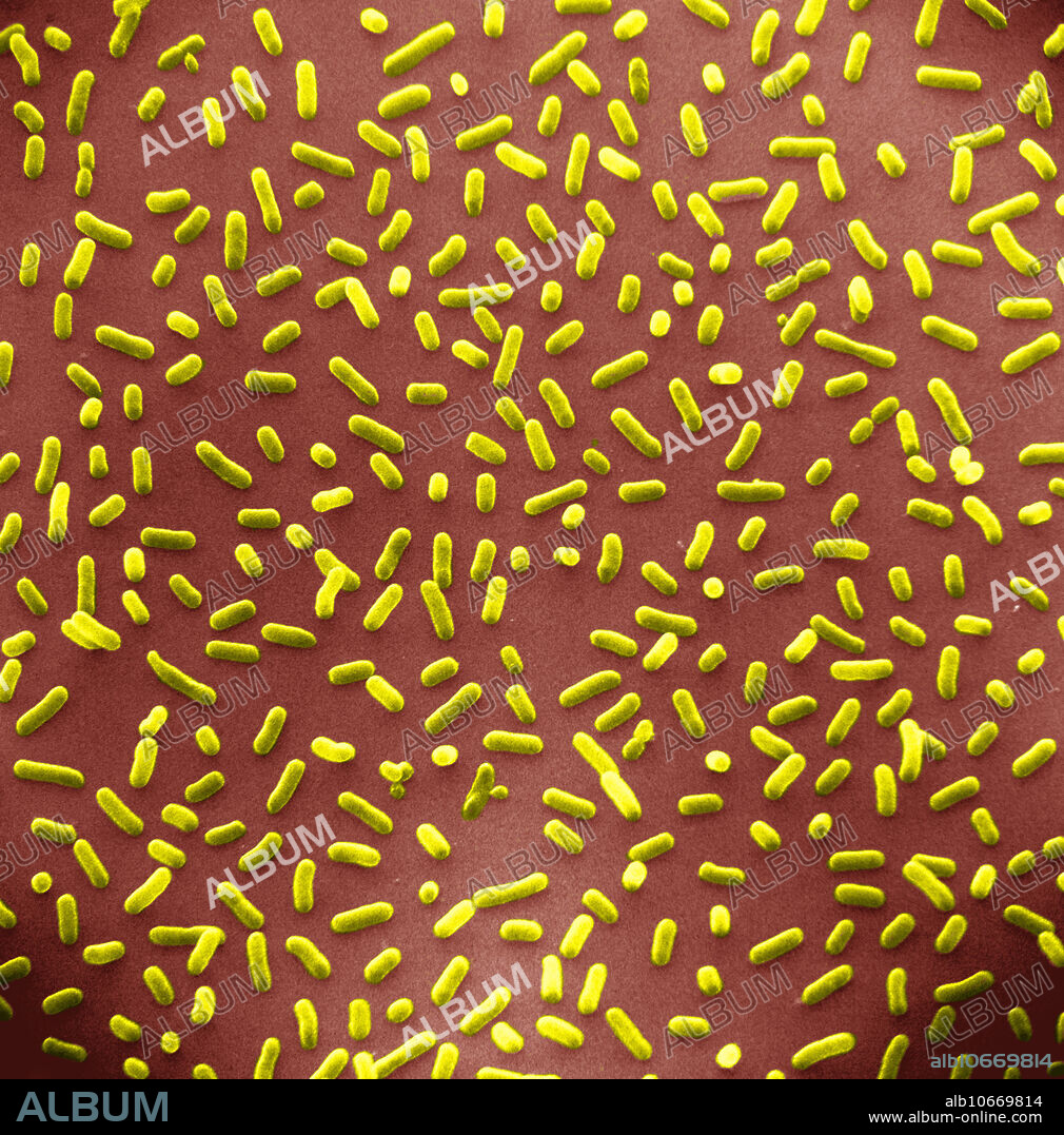 Colour enhanced scanning electron microscopy (SEM) or Escherichia coli. E. coli are present in the intestinal contents of animals and are thus also called the intestinal rods. They are used as indicators of contamination with fecal material. In the past, some of these originally harmless bacteria developed toxins and became a serious health hazard to humans and animals. (7,000x at 4 x 4 ).