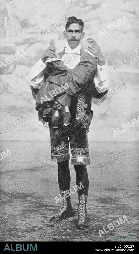 Laloo Ramparsad (1874 - 1905) was an Indian Muslim sideshow performer. He had a parasitic twin protruding from his stomach attached at its shoulders, with a rudimentary body and legs and arms. The twin had no brain but did have a penis, with which he could urinate and get an erection. In spite of its gender, the twin was often dressed in girl's clothes to add interest to Laloo's performance. They shared a bloodstream and Laloo could feel when the twin was touched. Laloo, worked with P. T. Barnum as one of his sideshow performers, and participated in the 1899 protest to have performers referred to as 'prodigies' instead of 'freaks'. He died in 1905 in a train crash in Mexico. The Wonder Book of Freaks and Animals in the Barnum & Bailey Greatest Show on Earth, 1898 (cropped and cleaned).