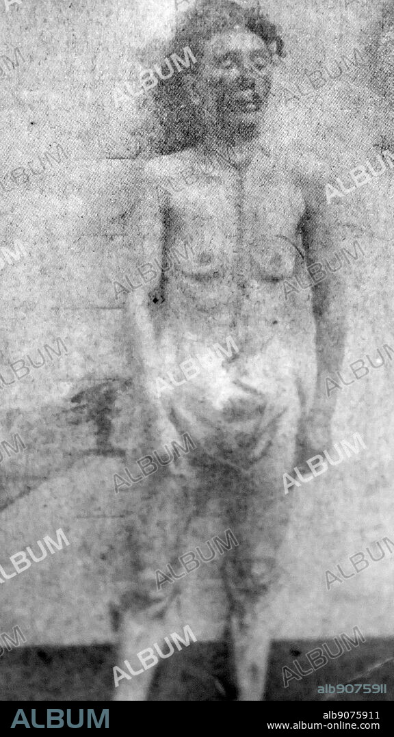 Photograph of the remains of Catherine Eddowes. Catherine "Kate" Eddowes (1842-1888) a victim of Jack the Ripper, an unidentified serial killer believed to have been active in and around the Whitechapel district of London in 1888.