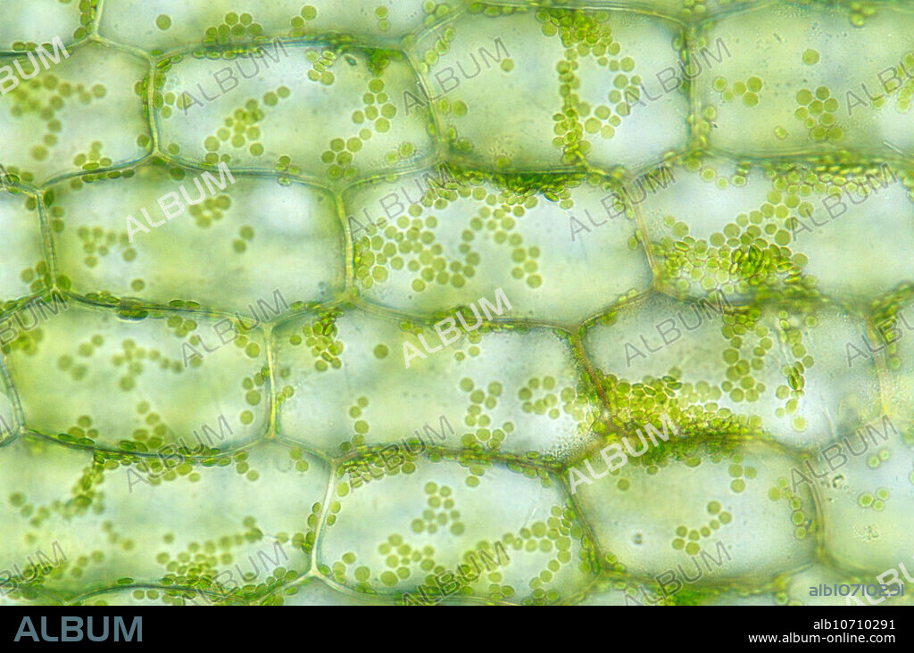 Osmosis in elodea plant cells under a microscope