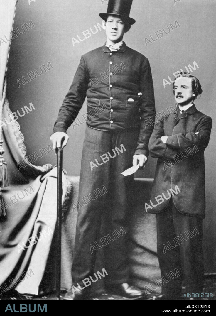 Hugh Murphy, known by many names, including Barnum's Famous Irish Giant, the Irish Giant, the Colossal Irish Giant, James Murphy, Patrick Murphy and Captain Murphy. He stood 7 ft 3.4 inches tall.