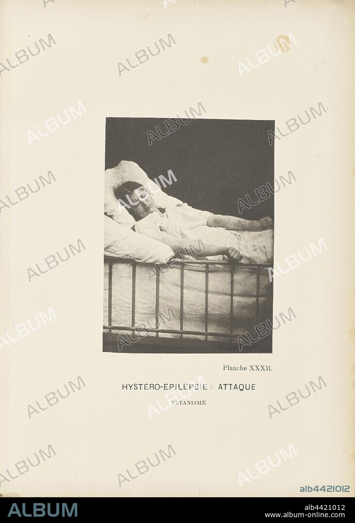 Hystéro-Épilepsie: Attaque Tétanisme, Paul-Marie-Léon Regnard (French, 1850 - 1927), Paris, France, 1878, Photogravure, 10 × 7.2 cm (3 15/16 × 2 13/16 in.).