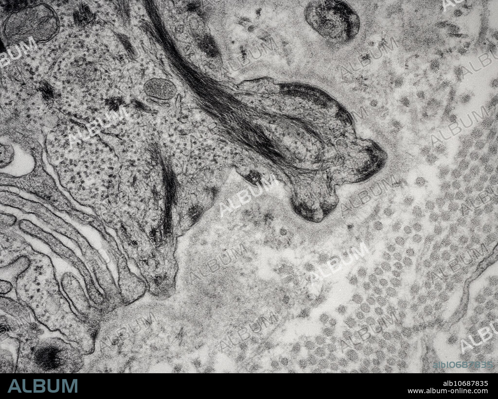 Transmission electron micrograph of hemidesmosome in skin. Magnification: 40,000X.