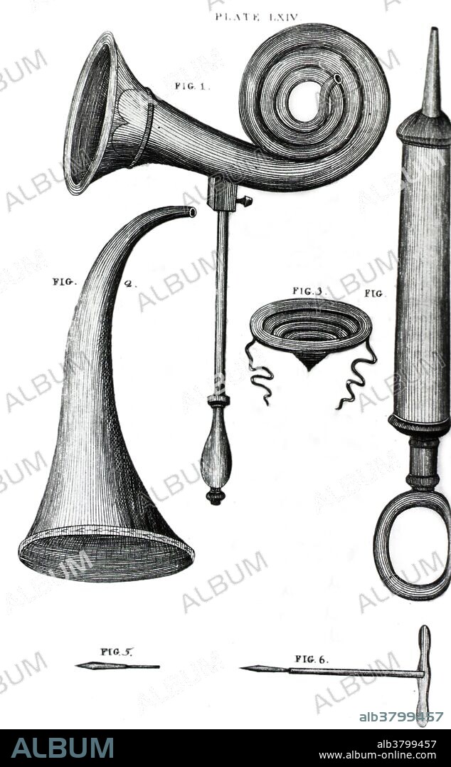Ear trumpets. Engraving from the 1790s of ear trumpets and a syringe or clyster. These devices were designed to relieve deafness. The first ear trumpet design (Fig. 1) is a large, coiled design with a handle. The second ear trumpet (Fig. 2) is a curved design with no handle. The third (Fig. 3) was attached onto the ear with string. Ear trumpets were tubes which worked by amplifying sound as it passed from the wide end to the narrow end. The syringe (at right) was used to remove excessive earwax or an obstacle blocking the ear canal. The syringe directed a jet of warm water into the ear which then dislodged the blockage.