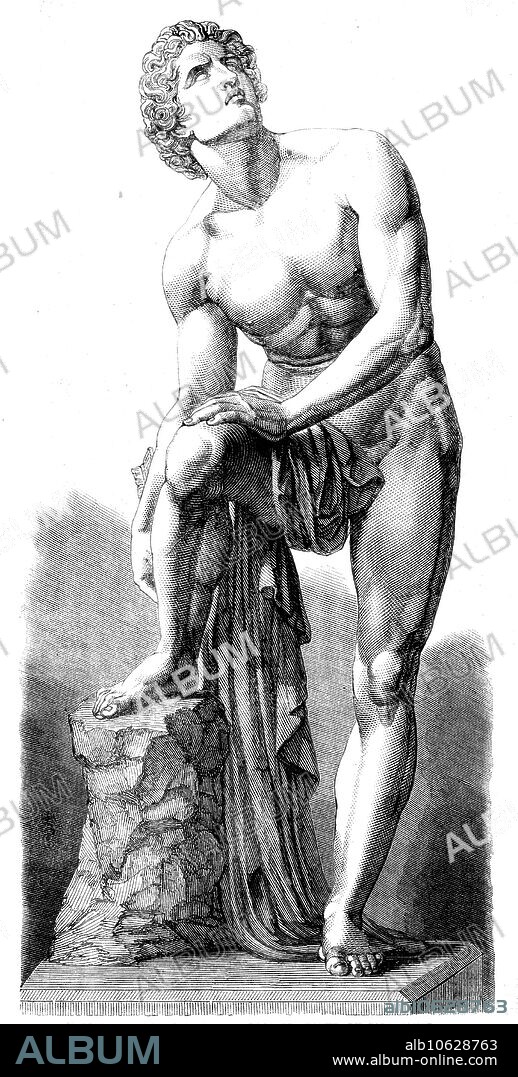 The International Exhibition:  "The Wounded Achilles", a plaster statue, by Carl Cauer, 1862. 'The action of Achilles endeavouring to extract the arrow from his heel, and his heroic expression "dignifying pain," are very good; but, in some respects, the model scarcely supports the sculptor's reputation, some parts of the anatomy not being correctly expressed. The occasional puffiness of the muscles might, it is true, disappear in the finished statue; but the extremities are too small, and there is too much weakness in the tendinous parts for the mighty hero of the "Iliad," making due allowance for his agility and swiftness'. From "Illustrated London News", 1862.