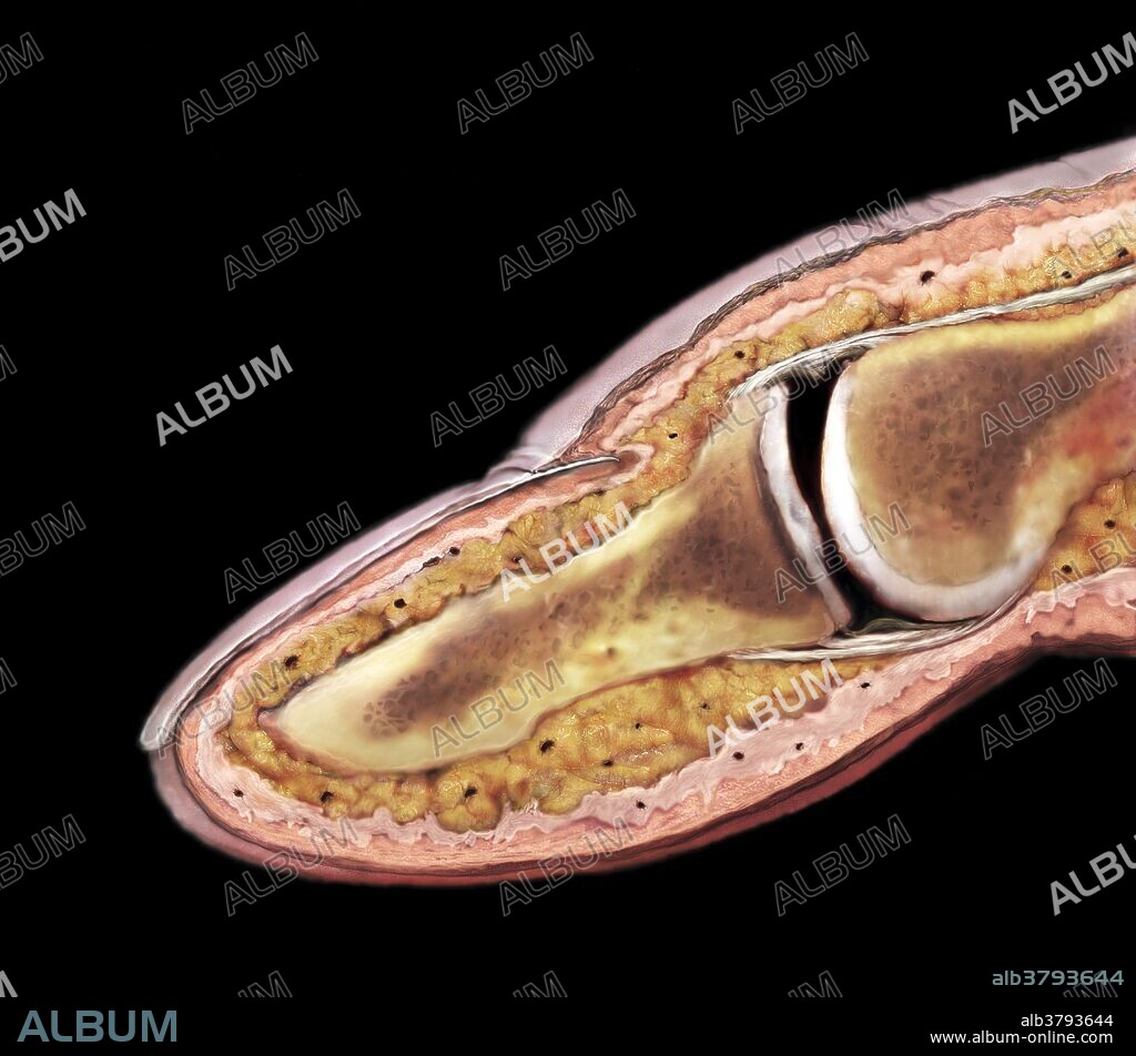 Cross section of a human fingertip (distal phalanx). A thick pad of subcutaneous fat (yellow) protects the bone, vessels, and nerves. The root of the finger nail is tucked into the nail groove, a folded pocket of skin which makes up the cuticle.
