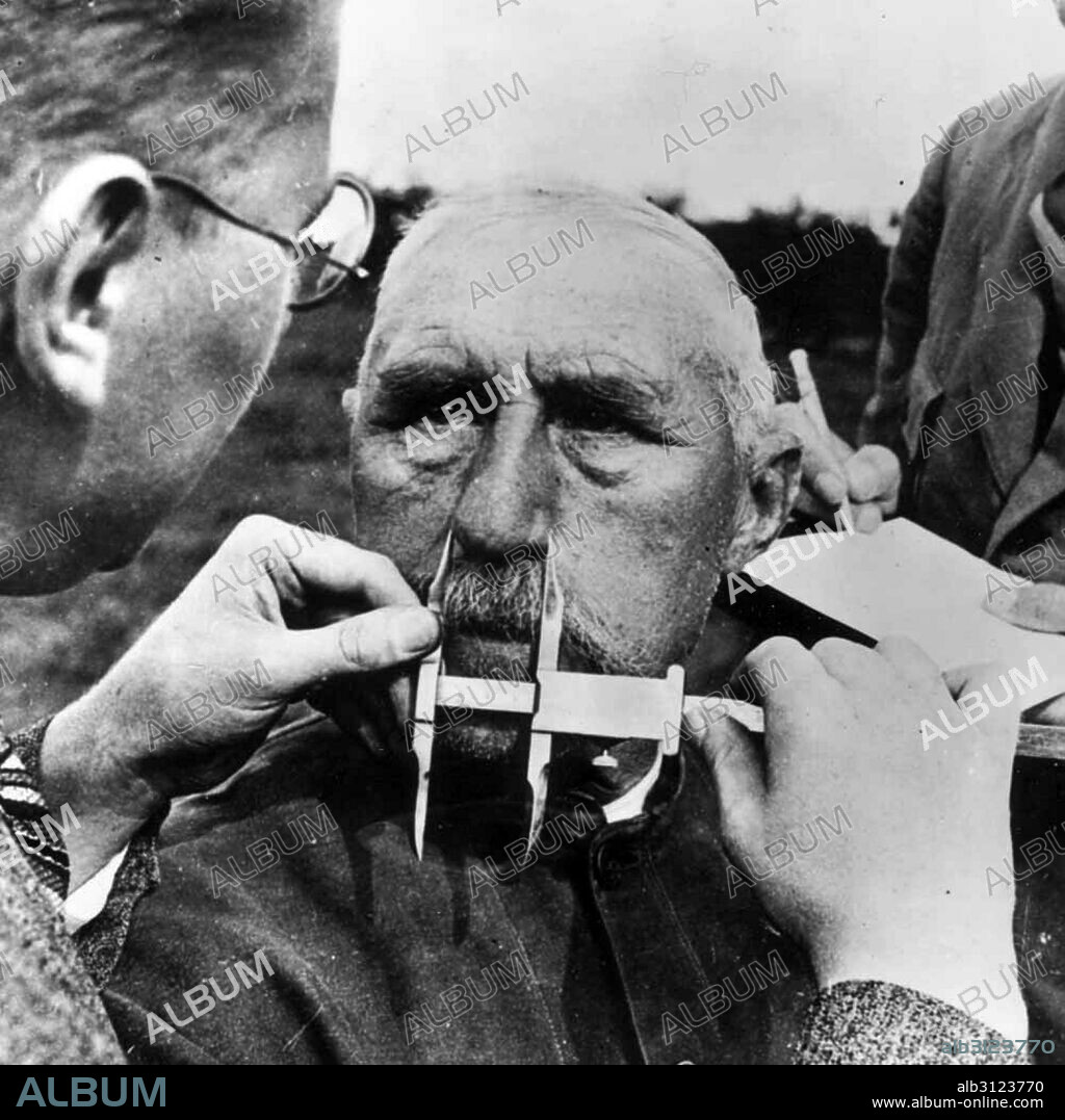 A man having his nose measured during Aryan race determination tests under Nazi Germany's Nuremberg Laws that was applied to determine whether a person was considered a "Jew".