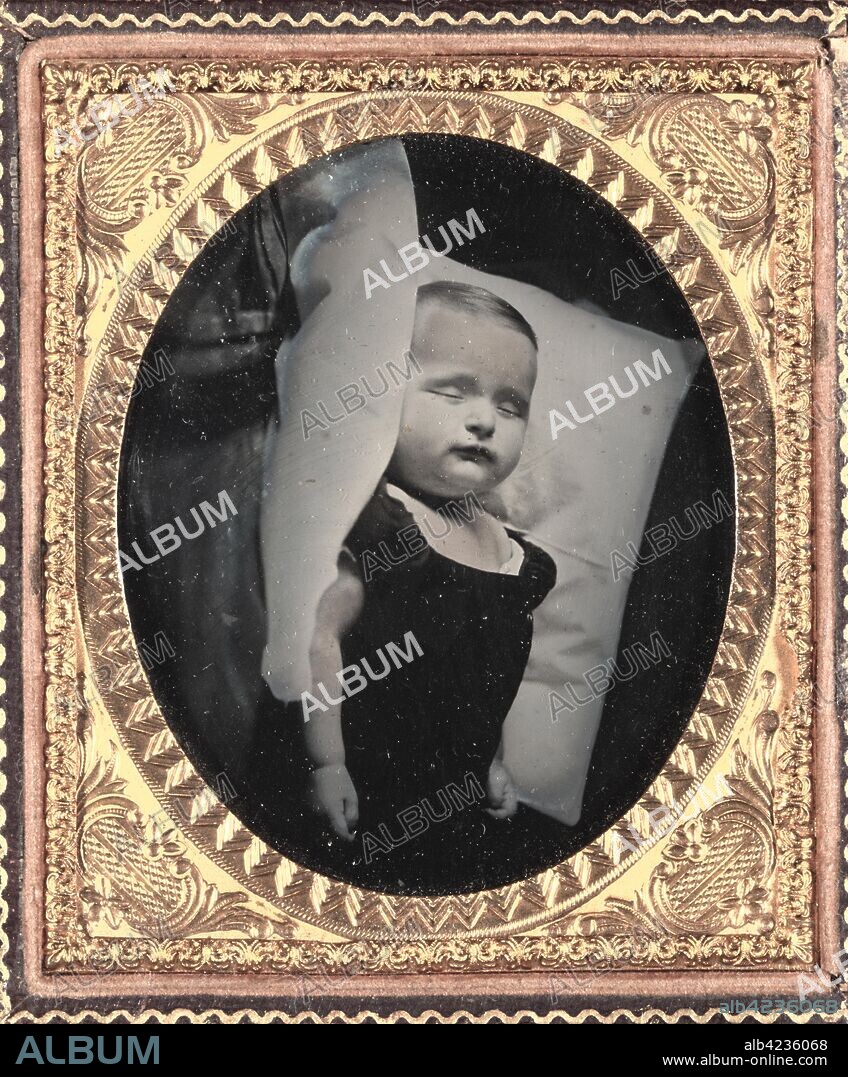 Post-Mortem on Pillow, Vertical, c. 1850. Unidentified Photographer. Ambrotype, tinted, sixth plate; image: 7 x 8.3 cm (2 3/4 x 3 1/4 in.); case: 8 x 9.3 cm (3 1/8 x 3 11/16 in.); matted: 48.3 x 61 cm (19 x 24 in.).