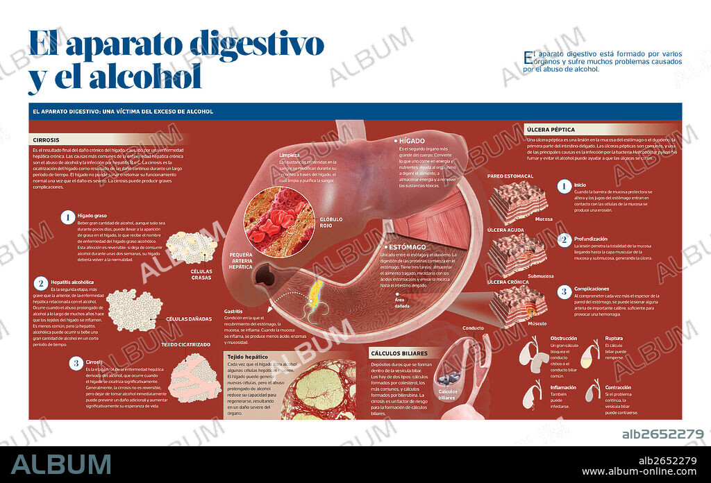 El aparato digestivo y el alcohol. Infografía sobre los órganos que componen el aparato digestivo y los muchos problemas causados por el abuso de alcohol.